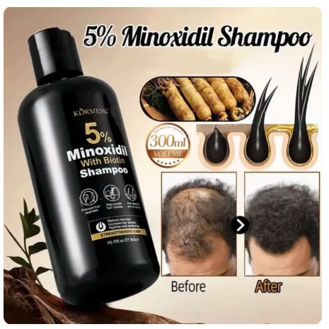 57% OFF BUY 1 TAKE 1 Minoxidil 5% Hair Grower Shampoo 300ml & Scalp Serum Spray 30ml For Hair Loss Treatment