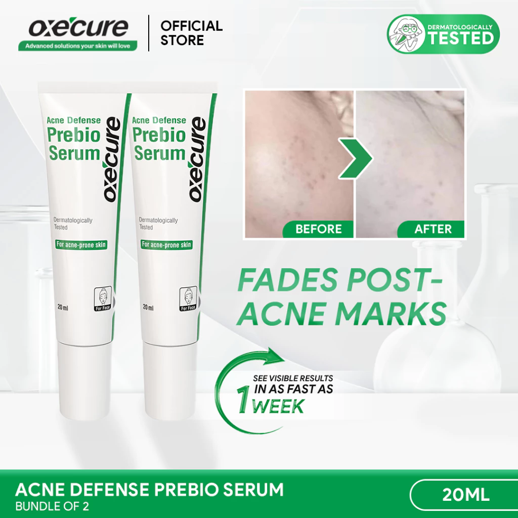 45% OFF OXECURE Acne Defense Prebio Serum 20ml Bundle of 2